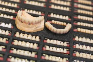 Mediniai dantys – tik mitas?