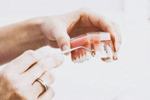 Prastą lietuvių dantų sveikatą lemia ir gaunamos pajamos?